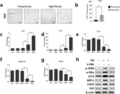 ER stress-induced YAP upregulation leads to chondrocyte phenotype loss in age-related osteoarthritis